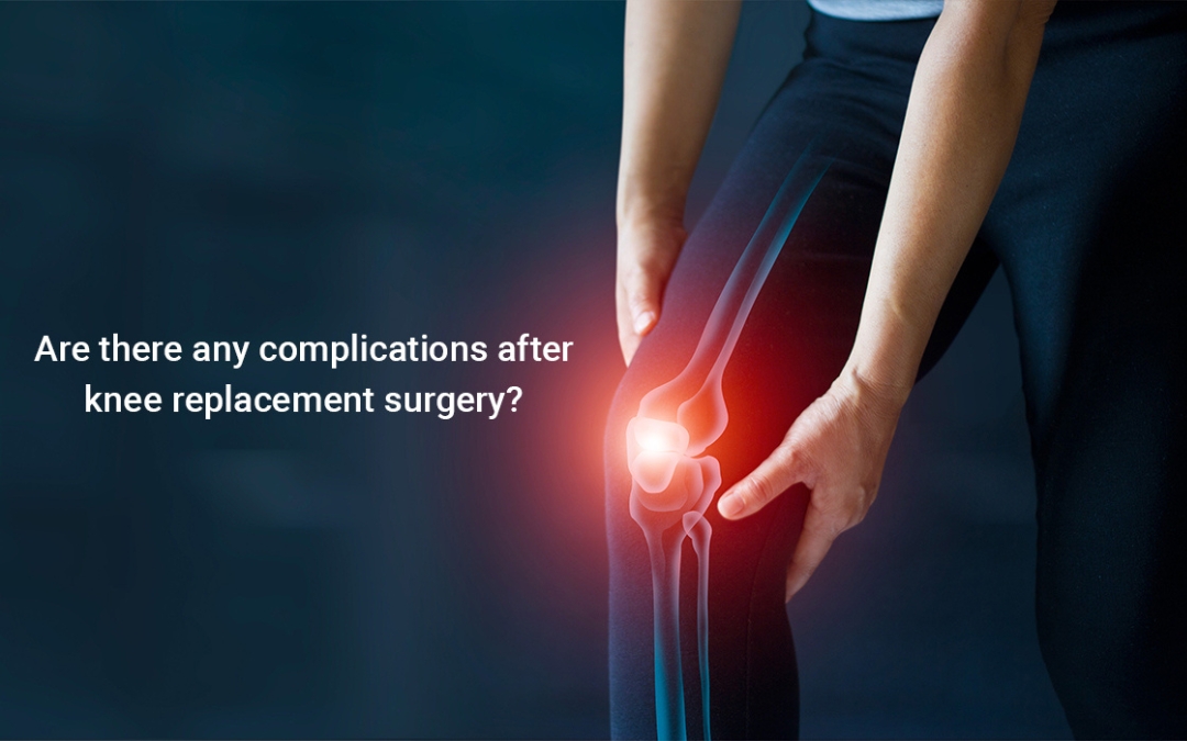 Navigating Knee Replacement: Understanding Complications and Strategies for Recovery